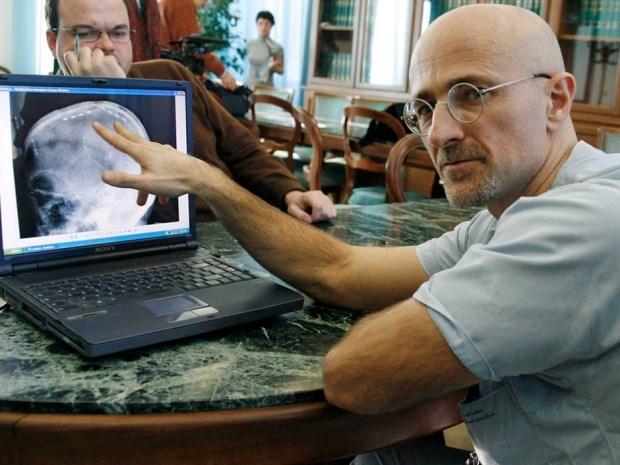 Dr Sergio Canavero operasyon ile ilgili bilgi verecek